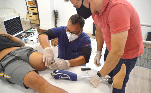 Aplicamos en Málaga una técnica pionera para situar una prótesis en una pierna amputada